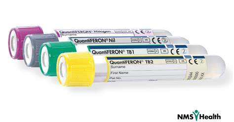 quantiferon tb gold plus test.